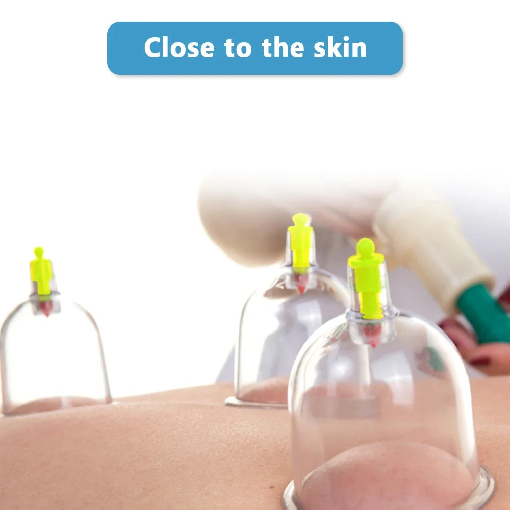 32-Piece Vacuum Cupping Massager Set for Body Therapy