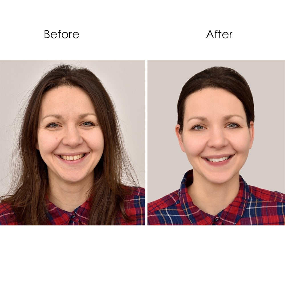 Silicone Anti-Wrinkle Patches
