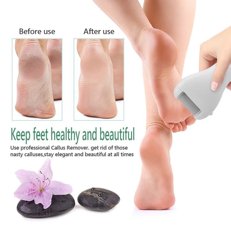 Professional Electric Foot File for Callus Removal - Charged Pedicure Tool