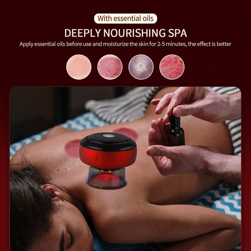 Electric Vacuum Cupping Massager