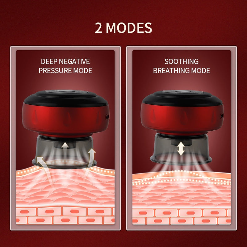 Electric Vacuum Cupping Massager